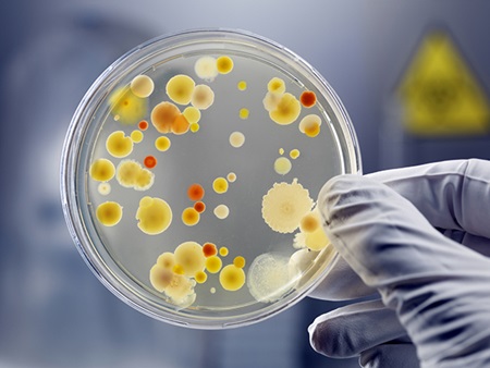 A petri dish showing growth.